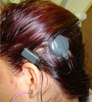 Implante Coclear Medel